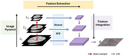 MF-Net: multi-scale feature extraction-integration network for unsupervised deformable registration